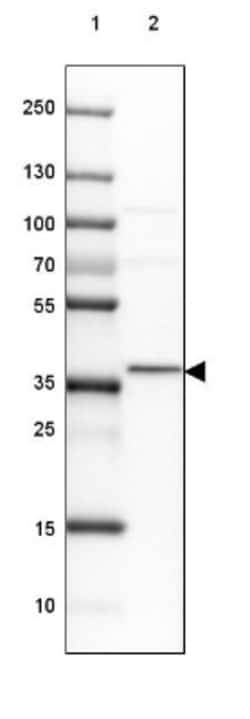 GBL Antibody, Novus Biologicals 25 &mu;L, Unlabeled:Antibodies, Polyclonal