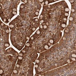 GBP4 Antibody, Novus Biologicals 0.1mL; Unlabeled:Antibodies, Polyclonal
