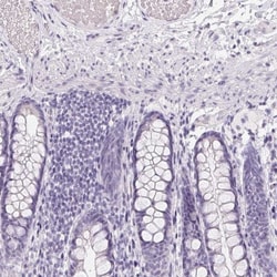 GBP6 Antibody, Novus Biologicals:Antibodies:Primary Antibodies