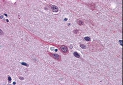 GBX2 Antibody, Novus Biologicals 0.1mg; Unlabeled:Antibodies, Polyclonal