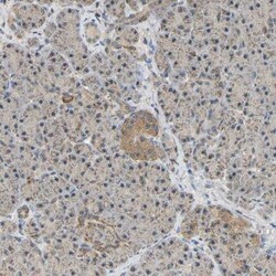 GCAT Antibody, Novus Biologicals 25 &mu;L | Buy Online | Novus Biologicals | Fisher Scientific