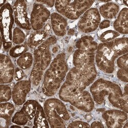 KLHL17 Antibody, Novus Biologicals:Antibodies:Primary Antibodies