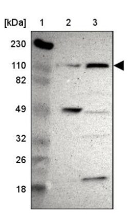 KLHL17 Antibody, Novus Biologicals:Antibodies:Primary Antibodies
