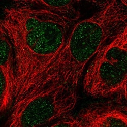 GCHFR Antibody, Novus Biologicals 0.1 mL | Buy Online | Novus Biologicals | Fisher Scientific