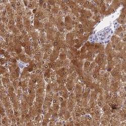 GCHFR Antibody, Novus Biologicals 0.1 mL | Buy Online | Novus Biologicals | Fisher Scientific