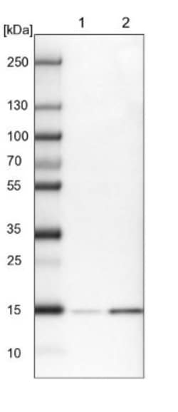 GCHFR Antibody, Novus Biologicals 0.1 mL | Buy Online | Novus Biologicals | Fisher Scientific