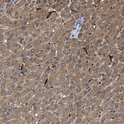 GCN1L1 Antibody, Novus Biologicals:Antibodies:Primary Antibodies