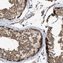 GCN1L1 Antibody, Novus Biologicals:Antibodies:Primary Antibodies
