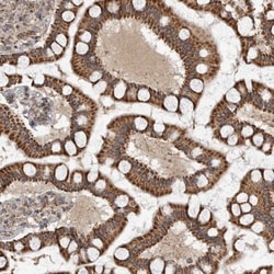 GCNT2 Antibody, Novus Biologicals:Antibodies:Primary Antibodies