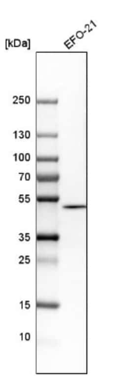 GCNT2 Antibody, Novus Biologicals:Antibodies:Primary Antibodies