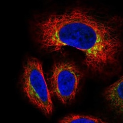 GCNT3 Antibody, Novus Biologicals 0.1mL; Unlabeled:Antibodies, Polyclonal