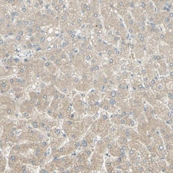 GCNT3 Antibody, Novus Biologicals 0.1mL; Unlabeled:Antibodies, Polyclonal