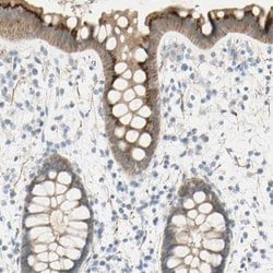 GCNT3 Antibody, Novus Biologicals 0.1mL; Unlabeled:Antibodies, Polyclonal