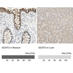 GCNT3 Antibody, Novus Biologicals 0.1mL; Unlabeled:Antibodies, Polyclonal