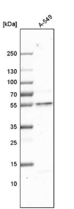 GCNT3 Antibody, Novus Biologicals 0.1mL; Unlabeled:Antibodies, Polyclonal