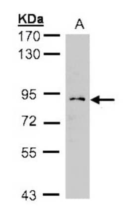 GCS1 Antibody, Novus Biologicals 0.1mL; Unlabeled:Antibodies, Polyclonal