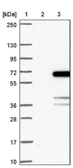GDAP2 Antibody, Novus Biologicals 25 &mu;L | Buy Online | Novus Biologicals | Fisher Scientific
