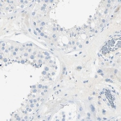 GDF-15 Antibody, Novus Biologicals 0.1mL; Unlabeled:Antibodies, Polyclonal