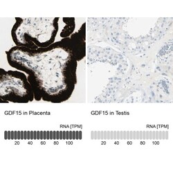 GDF-15 Antibody, Novus Biologicals 0.1mL; Unlabeled:Antibodies, Polyclonal
