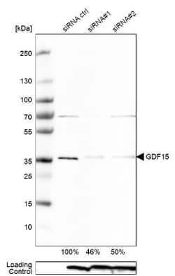 GDF-15 Antibody, Novus Biologicals 0.1mL; Unlabeled:Antibodies, Polyclonal
