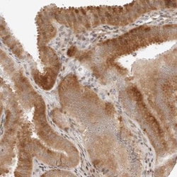 GEM Antibody, Novus Biologicals 25 &mu;L; Unlabeled:Antibodies, Polyclonal