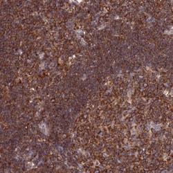 GEM Interacting Protein Antibody, Novus Biologicals 25 &mu;L, Unlabeled:Antibodies,