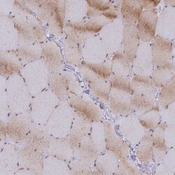 GEM Interacting Protein Antibody, Novus Biologicals 25 &mu;L, Unlabeled:Antibodies,