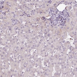 GEMIN2 Antibody, Novus Biologicals 25 &mu;L, Unlabeled:Antibodies, Polyclonal