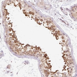 GEMIN2 Antibody, Novus Biologicals 25 &mu;L, Unlabeled:Antibodies, Polyclonal