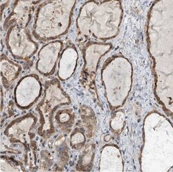 GEMIN8 Antibody, Novus Biologicals 0.1mL; Unlabeled:Antibodies, Polyclonal