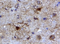 GFAP Antibody, Novus Biologicals 0.1mg; Unlabeled:Antibodies, Polyclonal