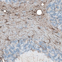 GFAP Antibody, Novus Biologicals 0.1mL; Unlabeled:Antibodies, Polyclonal