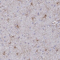 GFAP Antibody, Novus Biologicals 0.1mL; Unlabeled:Antibodies, Polyclonal