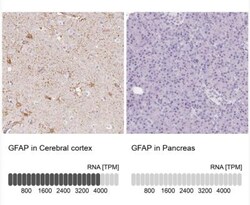 GFAP Antibody, Novus Biologicals 25 &mu;L | Buy Online | Novus Biologicals | Fisher Scientific