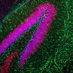 GFAP Antibody, Novus Biologicals:Antibodies:Primary Antibodies