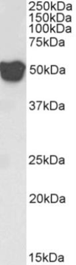 GFAP Antibody, Novus Biologicals 0.1mg; Unlabeled:Antibodies, Polyclonal