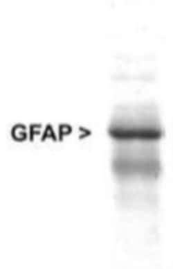 GFAP Antibody, Novus Biologicals 0.05mL | Buy Online | Novus Biologicals | Fisher Scientific