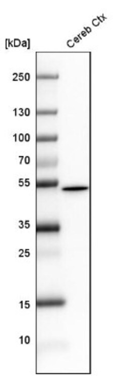 GFAP Antibody, Novus Biologicals 0.1mL; Unlabeled:Antibodies, Polyclonal