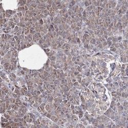 GFM1 Antibody, Novus Biologicals 0.1mL; Unlabeled:Antibodies, Polyclonal