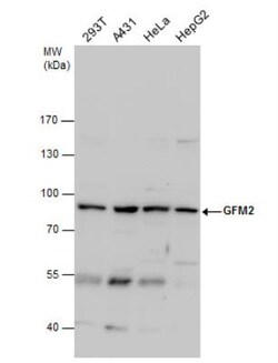 GFM2 Antibody, Novus Biologicals 0.1mL; Unlabeled:Antibodies, Polyclonal