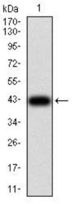 GFPT1 Antibody (1F1A4) - BSA Free, Novus Biologicals 0.1mg; Unlabeled:Antibodies,