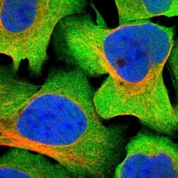 GFR alpha-3/GDNF R alpha-3 Antibody, Novus Biologicals 25 &mu;L; Unlabeled:Antibodies,