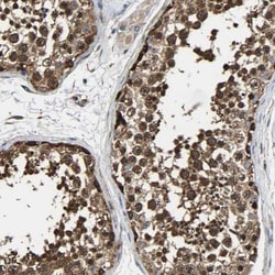 GFR alpha-3/GDNF R alpha-3 Antibody, Novus Biologicals 25 &mu;L; Unlabeled:Antibodies,