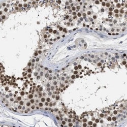 GGNBP2 Antibody, Novus Biologicals 25 &mu;L | Buy Online | Novus Biologicals | Fisher Scientific