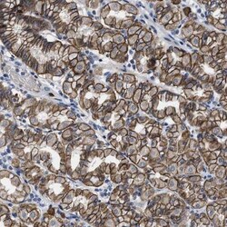GHITM Antibody, Novus Biologicals 0.1mL; Unlabeled:Antibodies, Polyclonal