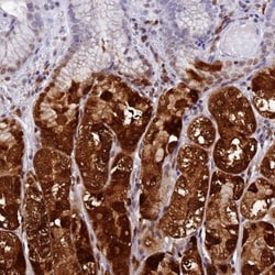 GIF Antibody, Novus Biologicals 0.1mL; Unlabeled:Antibodies, Polyclonal