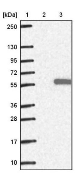 GIF Antibody, Novus Biologicals 0.1mL; Unlabeled:Antibodies, Polyclonal