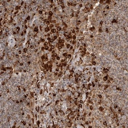 GILT/IFI30 Antibody, Novus Biologicals 0.1mL; Unlabeled:Antibodies, Polyclonal