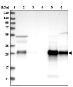 GILT/IFI30 Antibody, Novus Biologicals 0.1mL; Unlabeled:Antibodies, Polyclonal