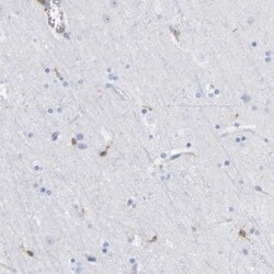 GIMAP4 Antibody, Novus Biologicals 25 &mu;L; Unlabeled:Antibodies, Polyclonal